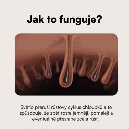 Eggo profesionální IPL zařízení na odstranění chloupků Lumer Pro IPL