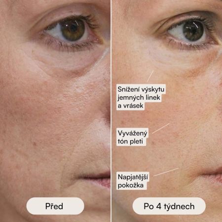 Eggo profesionální LED maska pro obnovu pleti Ilumi Pro LED