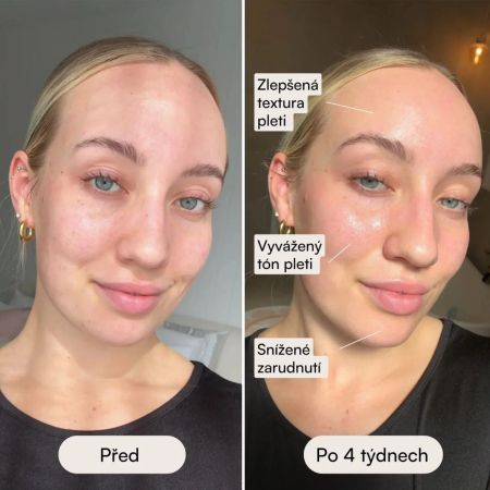 Eggo profesionální LED maska pro obnovu pleti Ilumi Pro LED