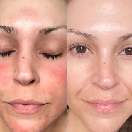 Eggo hydratační krém pro všechny typy pleti, Zen Defence, 50ml